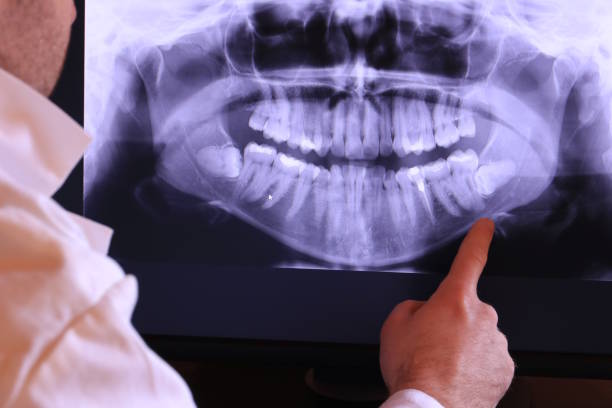 Emergency Dental Filling Replacement in NJ